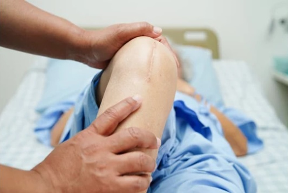 Understanding Knee Replacement Surgery: A Comprehensive Guide