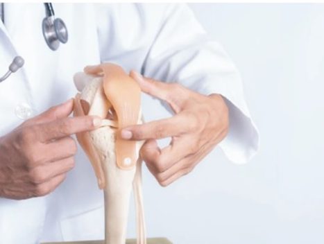 knee replacement surgeon