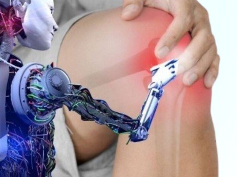 Robotic Knee Replacement