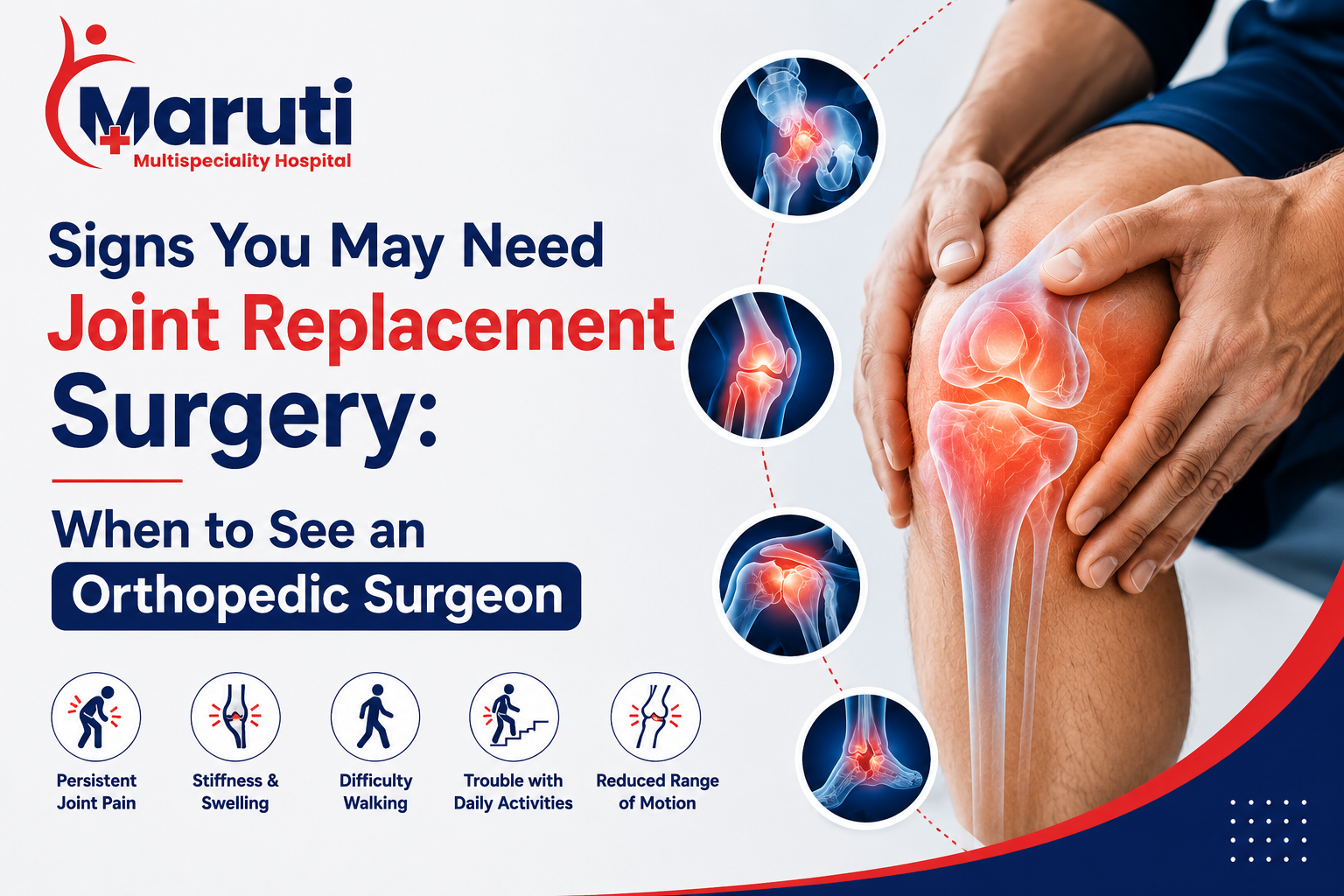 Signs You May Need Joint Replacement Surgery: When to See an Orthopedic Surgeon